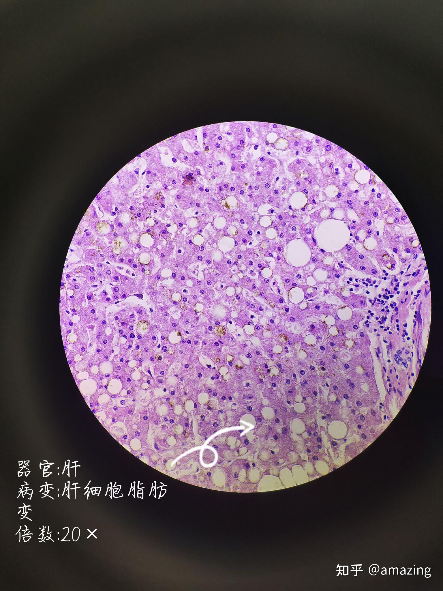 目标文件过大无法复制到u盘_目标文件过大怎么放进u盘_ghost 目标文件过大