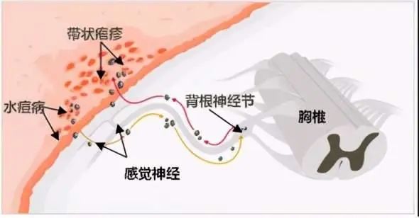 痛到怀疑人生_痛到怀疑人生配图_怀疑人生的痛